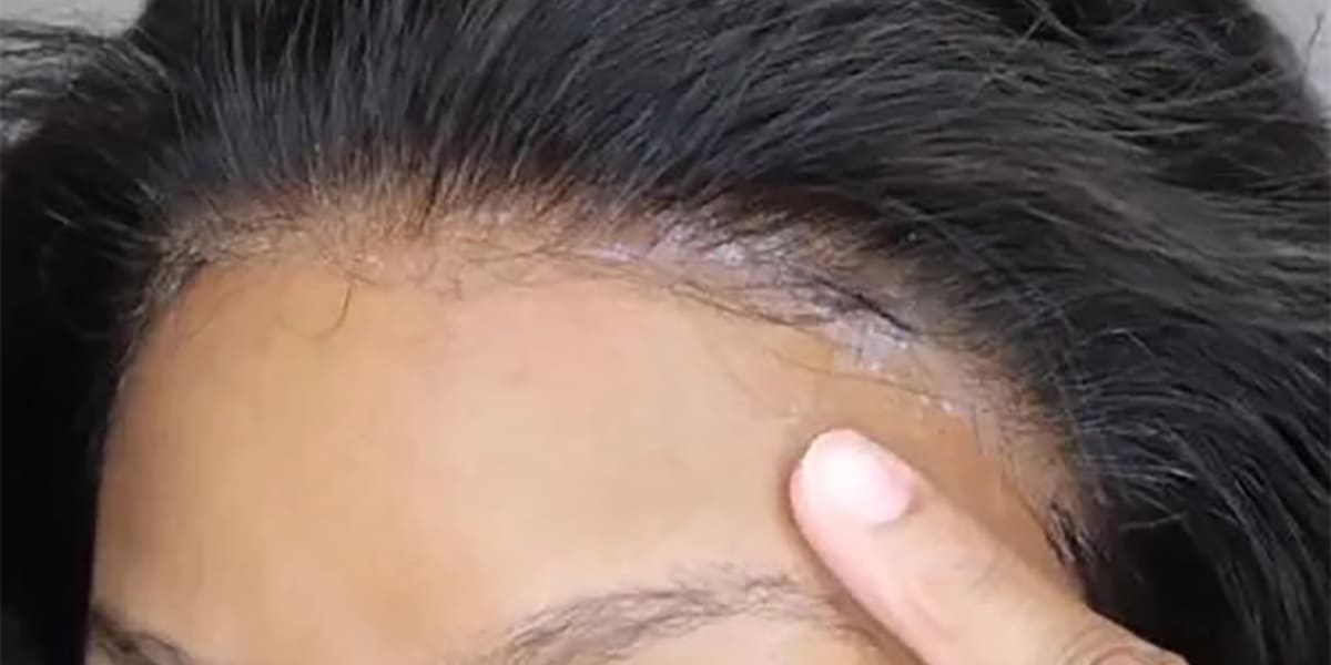 ¿Cuánto tiempo se debe pegar una peluca?