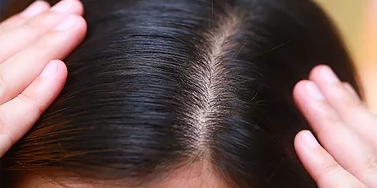 Qu’est-ce que la densité de perruque ?