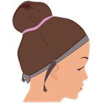 Fixation par élastique